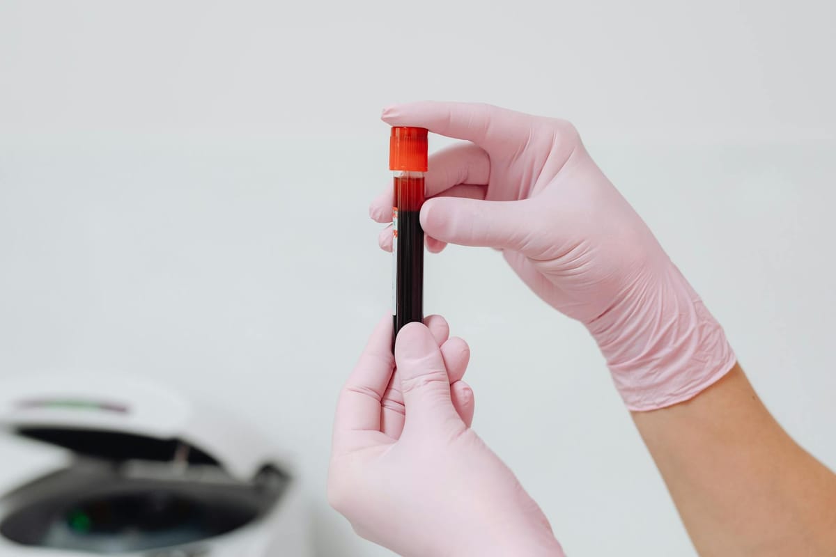 High CRP Blood Test: What Inflammation Markers Actually Mean