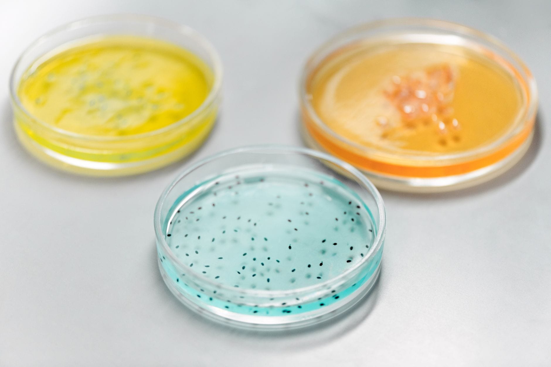 "Has Anyone Actually Had Success With Probiotics for Anxiety?" What 25+ Clinical Studies Reveal About the Gut-Brain Connection